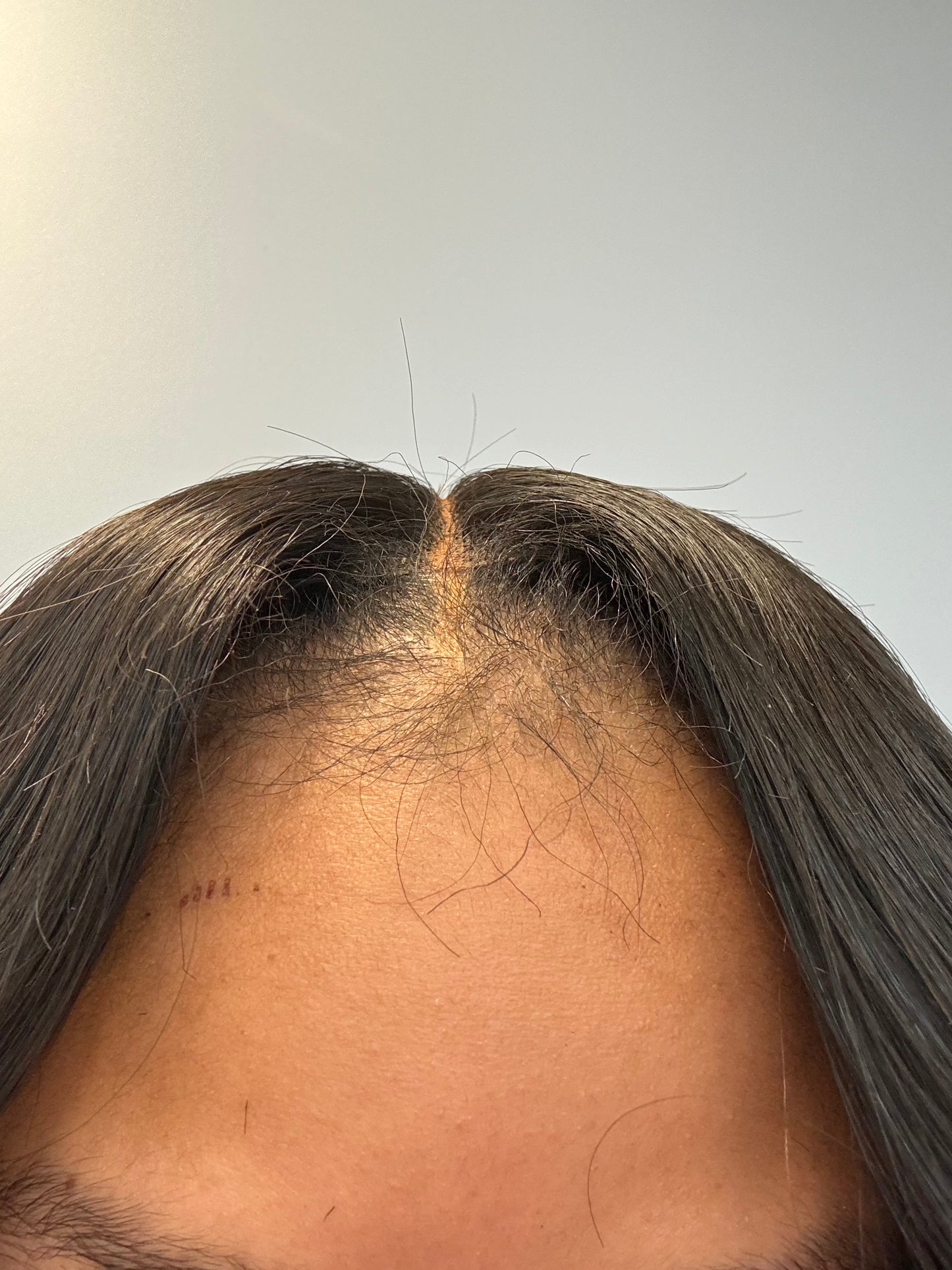 2x6 SOUTH INDIAN HD CLOSURE